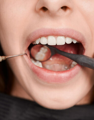 periodontoloji